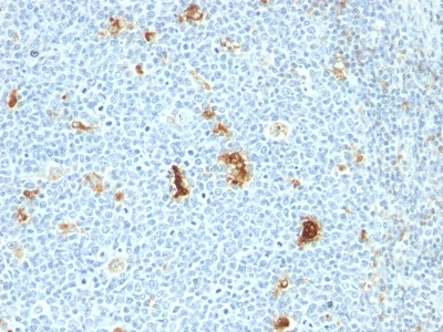 Formalin-fixed, paraffin embedded human tonsil sections stained with 100 ul anti-Calprotectin (clone SPM281) at 1:400. HIER epitope retrieval prior to staining was performed in 10mM Citrate, pH 6.0.